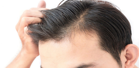 Please be careful about these hair oils as they could harm you!!