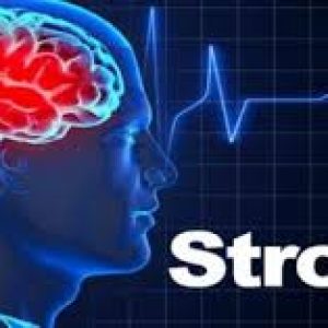 Precautions That May Help Reduce Stroke Risk